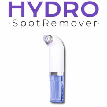 Hydro Spot Remover experiências e opiniões