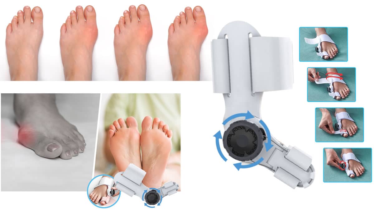 Bunion corrector that works