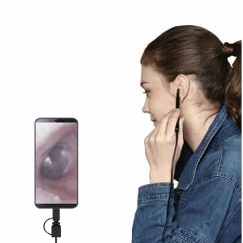 Earwax remover with camera, review and opinions