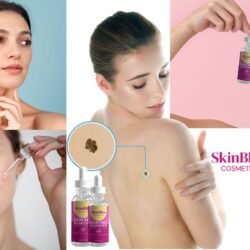 Skin Bliss, remove your moles and warts naturally and painlessly
