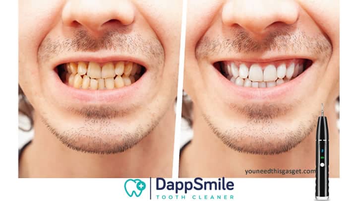 DappSmile, buy with discount