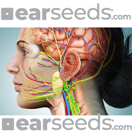 EarSeeds®, release of endorphins through acupuncture