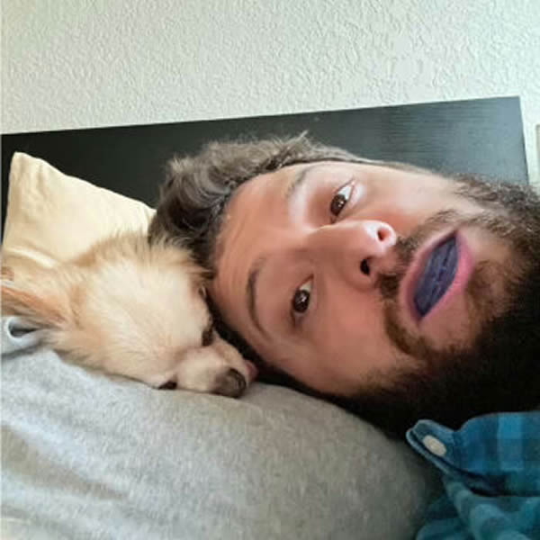 SleepZee antisnoring mouthpieze real user SleepZee antisnoring mouthpieze real user